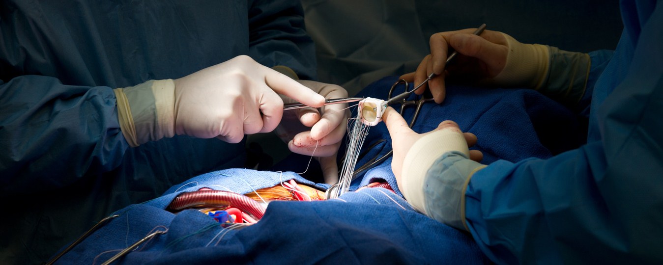 Питерские врачи успешно провели двустороннюю трансплантацию лёгких