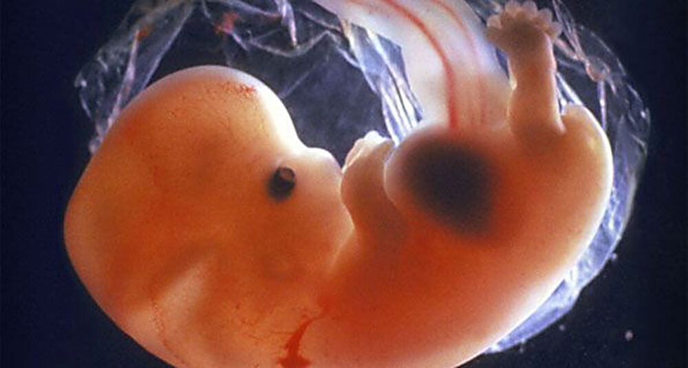От инфекций до летального исхода: Чем опасен медикаментозный аборт без наблюдения врача