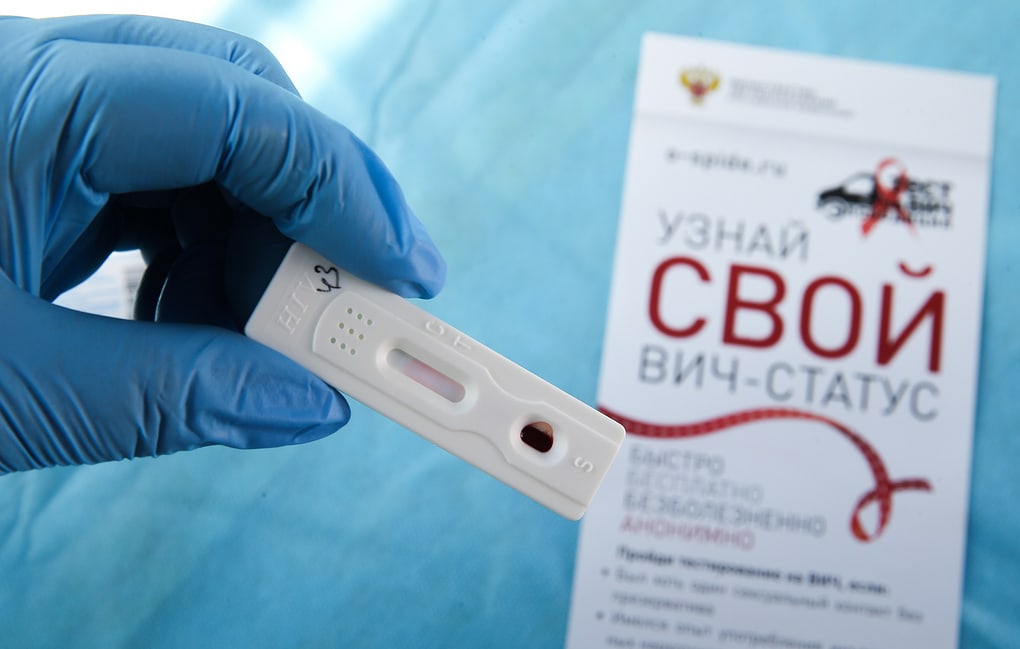 Новосибирский Минздрав выступил за введение доконтактной профилактики ВИЧ