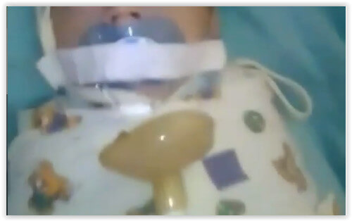 В Ингушетии пациентка роддома заклеила младенцу рот лейкопластырем и сняла это на видео