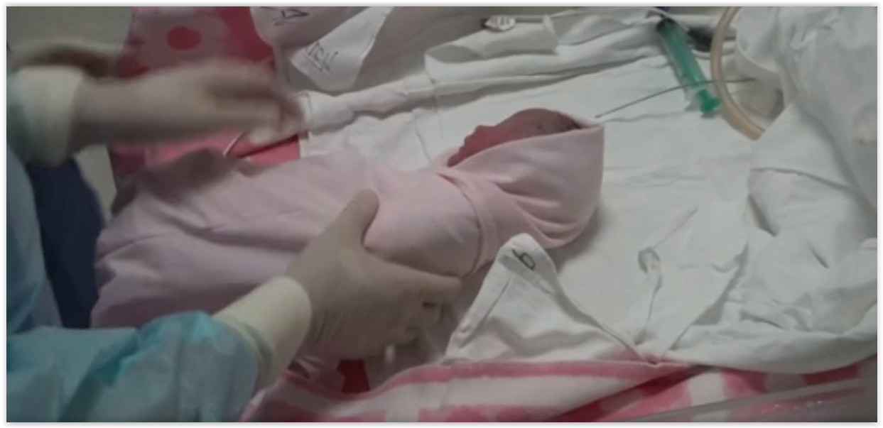 В РФ родился здоровый ребёнок после уникальной внутриутробной операции на спинномозговой грыже
