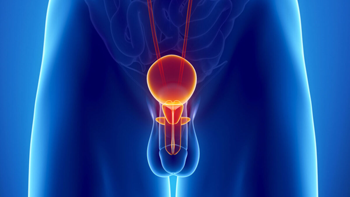 Хронический простатит: кто виноват и что делать? | Медицинская Россия