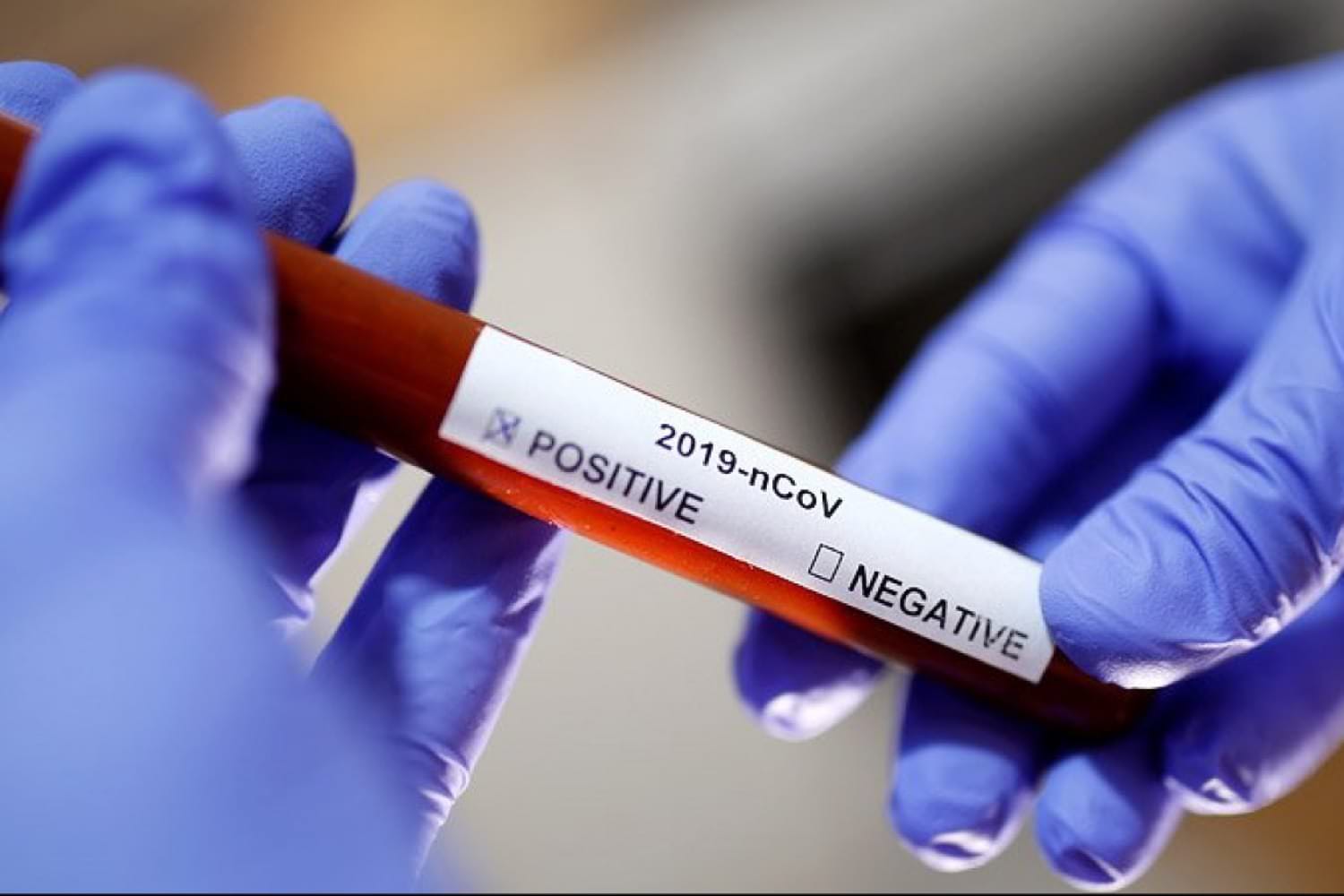 30% тестов на коронавирус дают ложноотрицательный результат