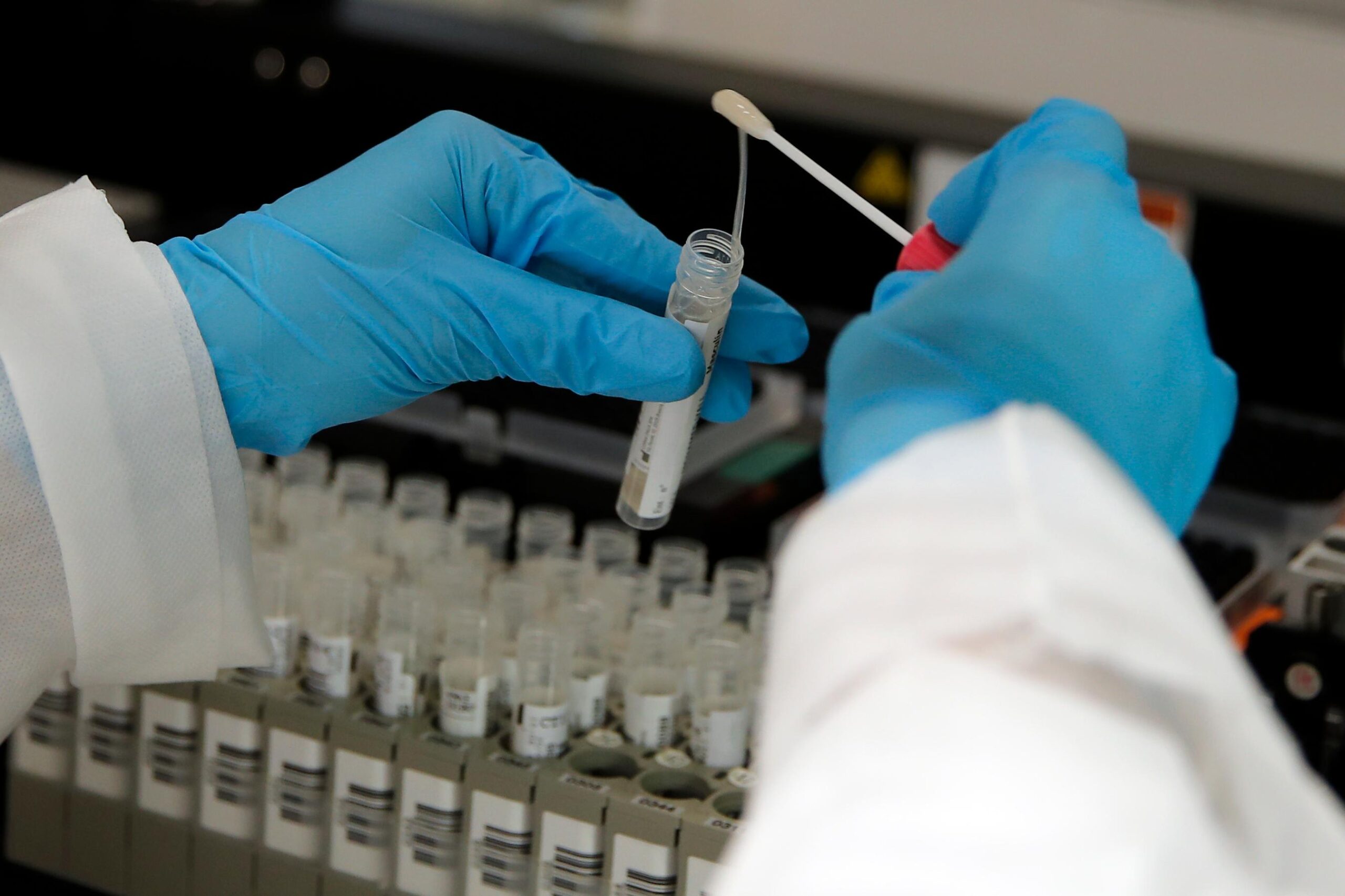 В Приамурье за нарушения частной лаборатории запретили проводить тесты на COVID