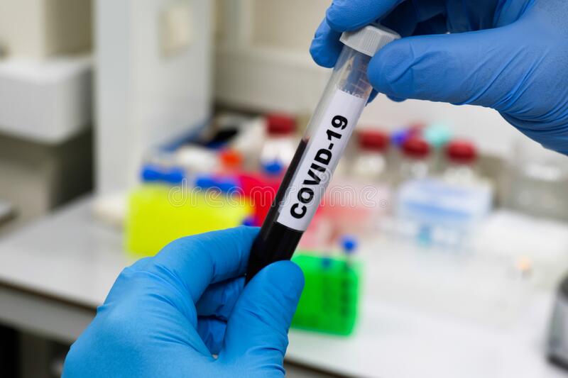«Это околонаучный фейк: группа крови не может повлиять на течение коронавируса»