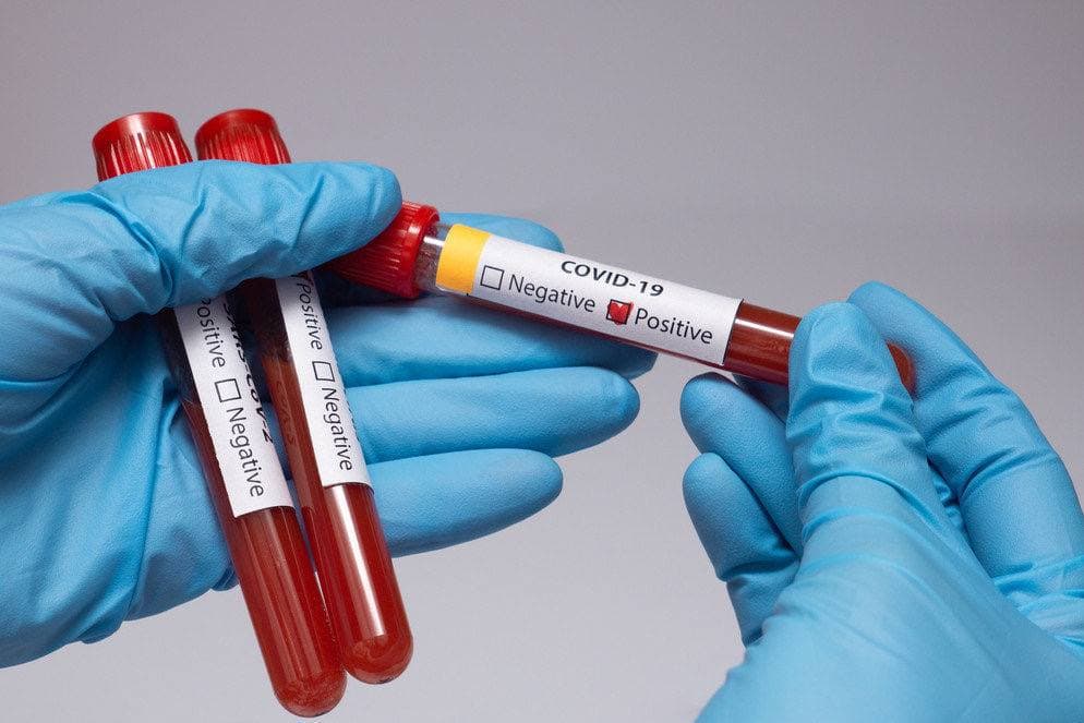 Поддельные сертификаты о COVID-прививках будут выявлять при помощи теста на антитела