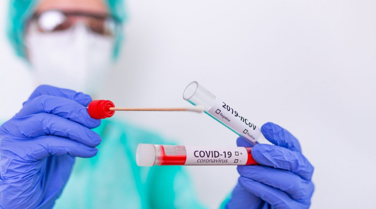 Мясников предложил отказаться от массового тестирования на коронавирус