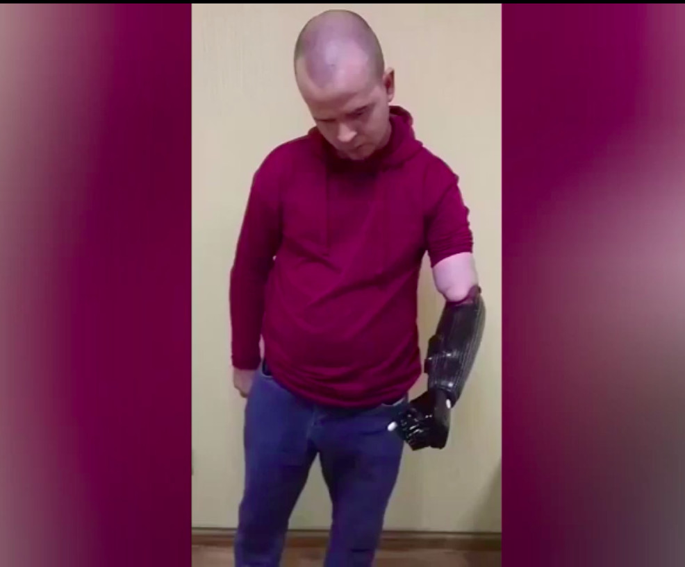 Благотворительные фонды собрали деньги на протезирование руки подростку из Ясиноват­ой