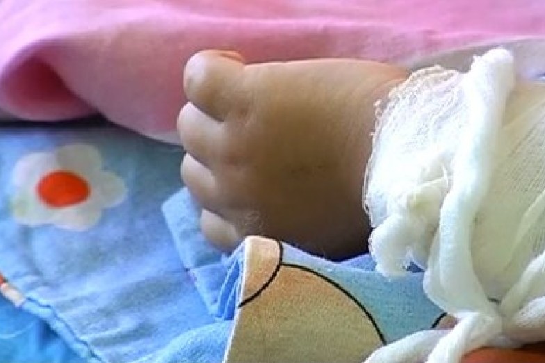В Дагестане от ожогов умер младенец, которого родители лечили гусиным жиром у знахарки