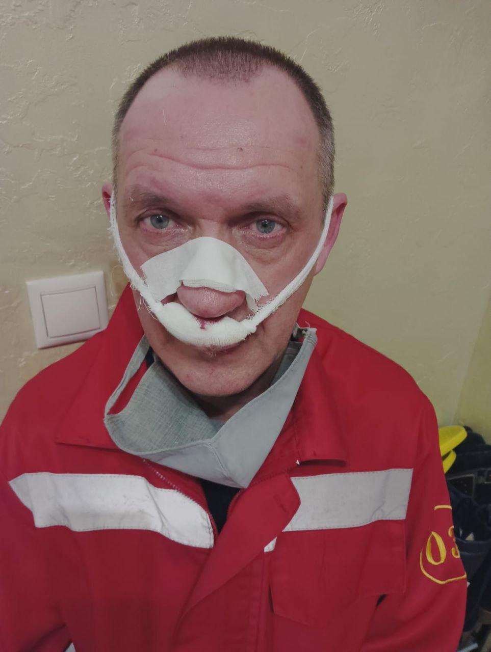 Сломали нос и разбили лицо: меньше чем за неделю совершено два нападения на медработников Краснодарской краевой БСМП