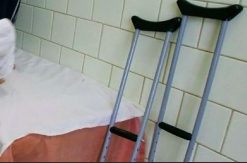 Пенсионерка из Липецка лечила ногу по советам из TikTok — она госпитализирована с химическими ожогами