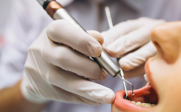 В Екатеринбурге сестры обвинили стоматологов в неправильной установке имплантов, которая привела к гнойному воспалению челюстей у обеих, — возбуждено два уголовных дела 