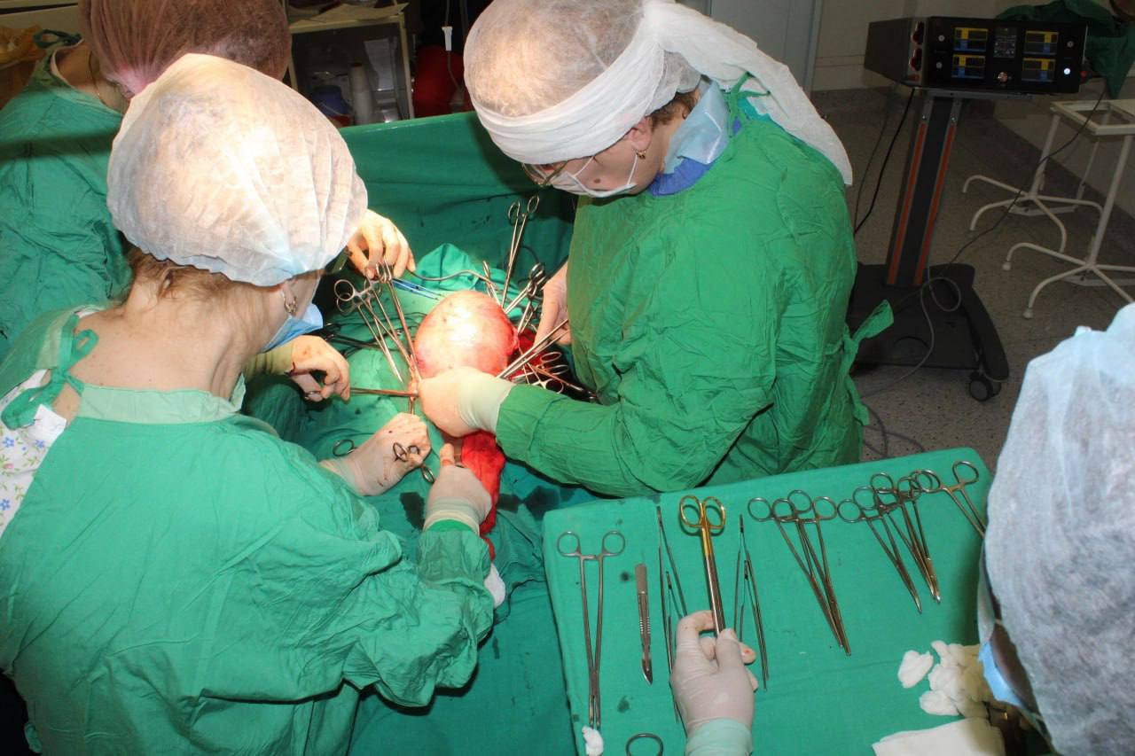 Подмосковные хирурги удалили пациентке огромную миому матки, которую диагностировали еще десять лет назад