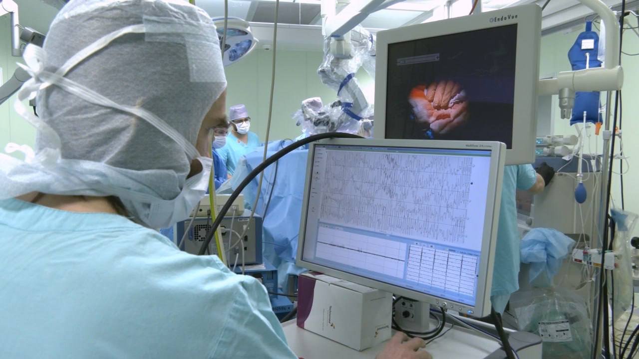 Новосибирские врачи выполнили уникальную операцию, которая помогла сохранить функцию речи после удаления опухоли головного мозга 5
