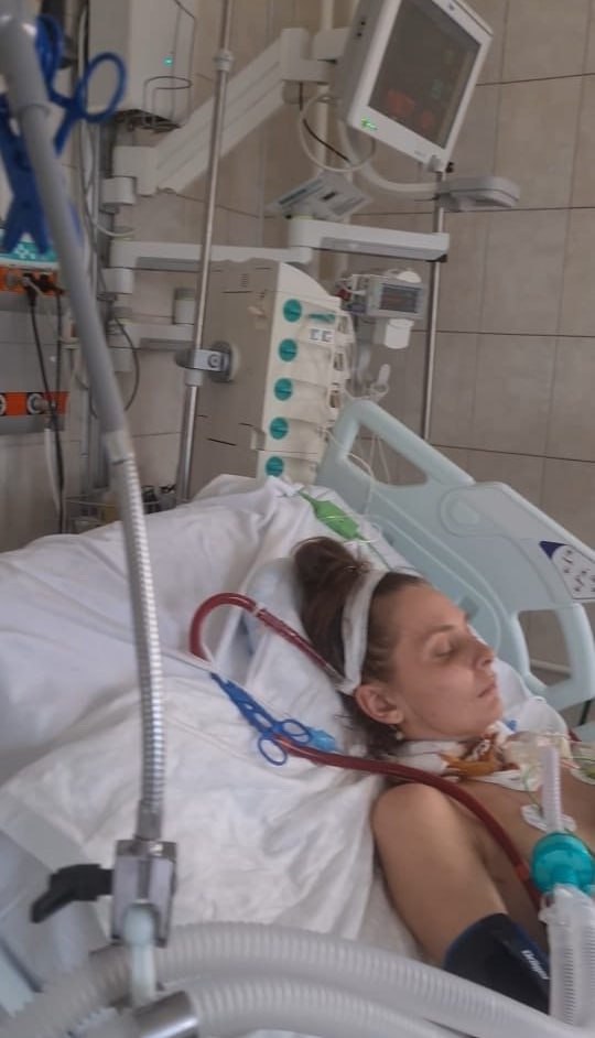 Московские врачи спасли пациентку от распространенного перитонита и сепсиса 2