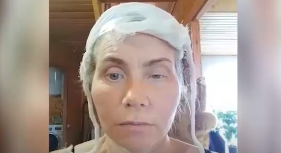 В Краснодарской БСМП отреагировали на жалобу пациентки, обвинившей врачей в том, что они забыли в пазухе тампон и сломали глазницу