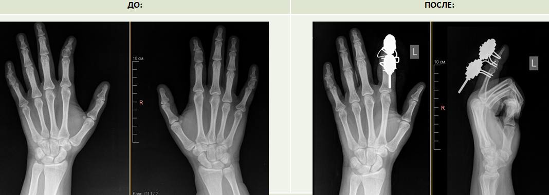 ⚡️Курганские врачи прооперировали близняшек с редкой аномалией 2