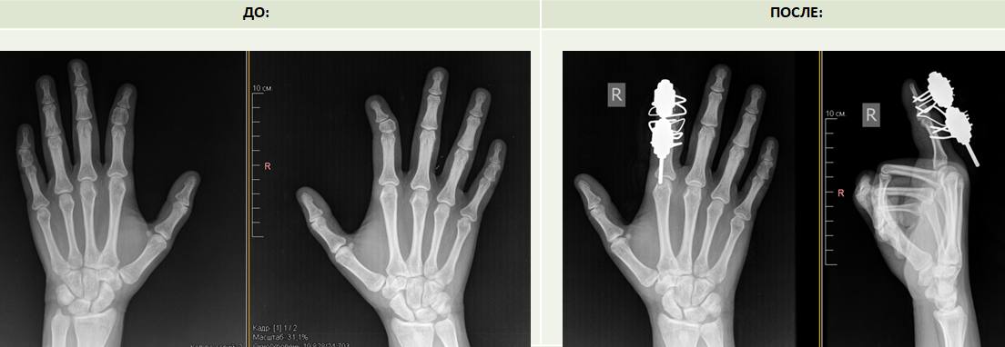 ⚡️Курганские врачи прооперировали близняшек с редкой аномалией 3