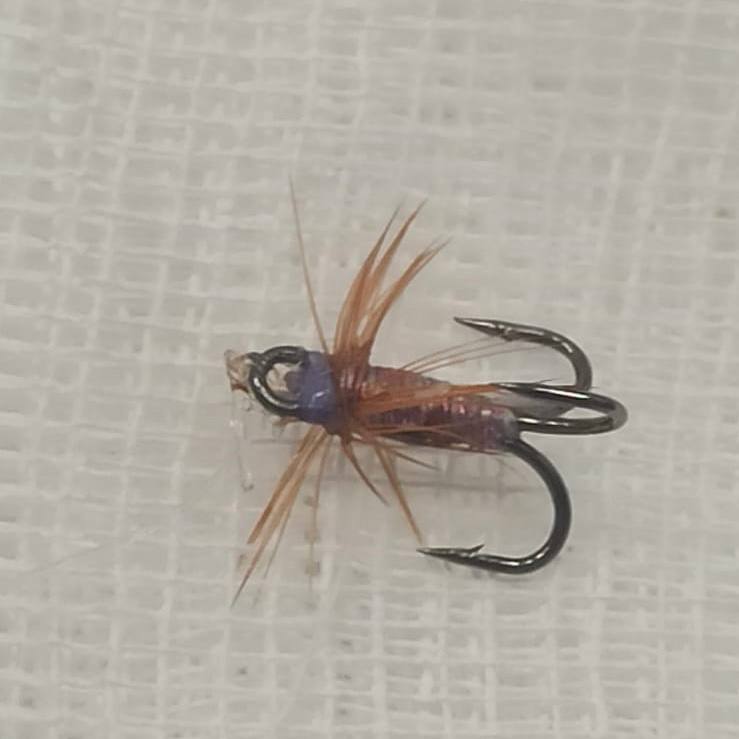 Красноярские врачи вытащили рыболовный крючок, который случайно проглотил пациент