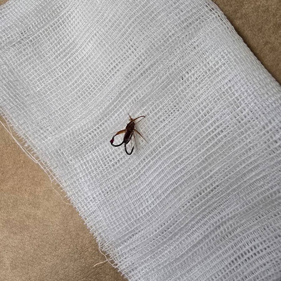 Красноярские врачи вытащили рыболовный крючок, который случайно проглотил пациент 3