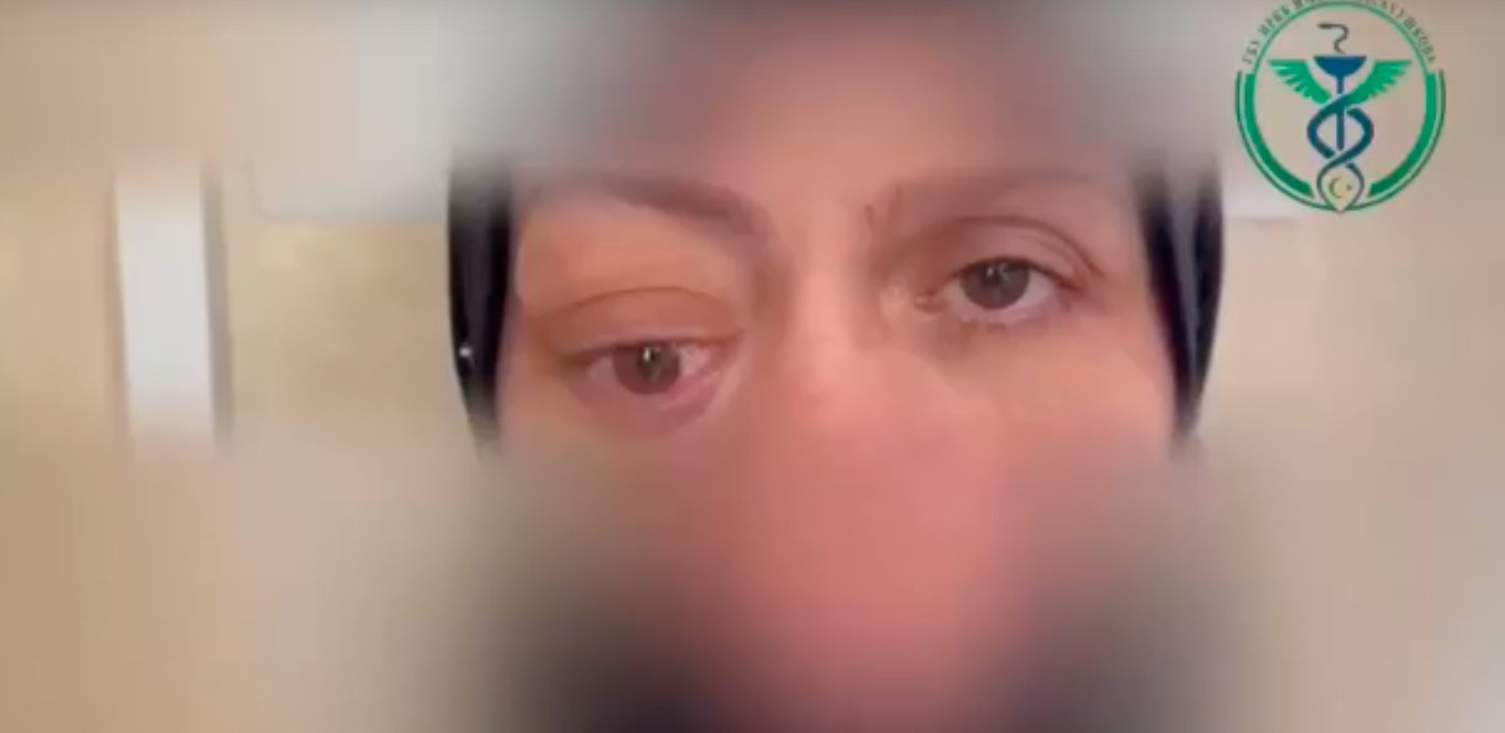 Хирурги из Ингушетии восстановили зрение пациентке с прорастающим в мозг образованием