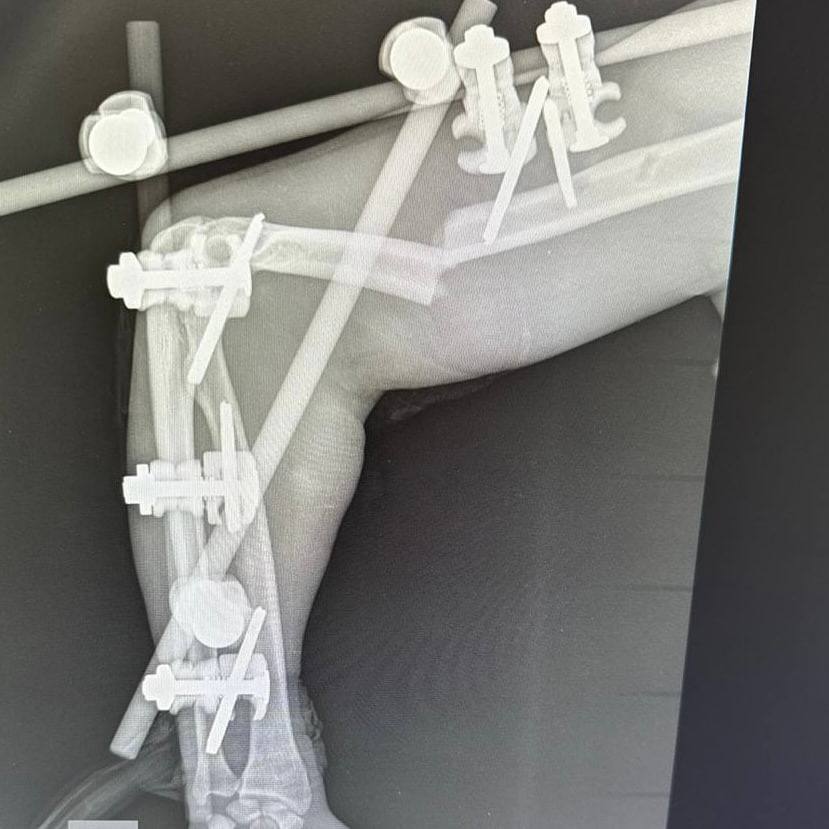 Нижегородские врачи вылечили пациента, который упал с 32 этажа