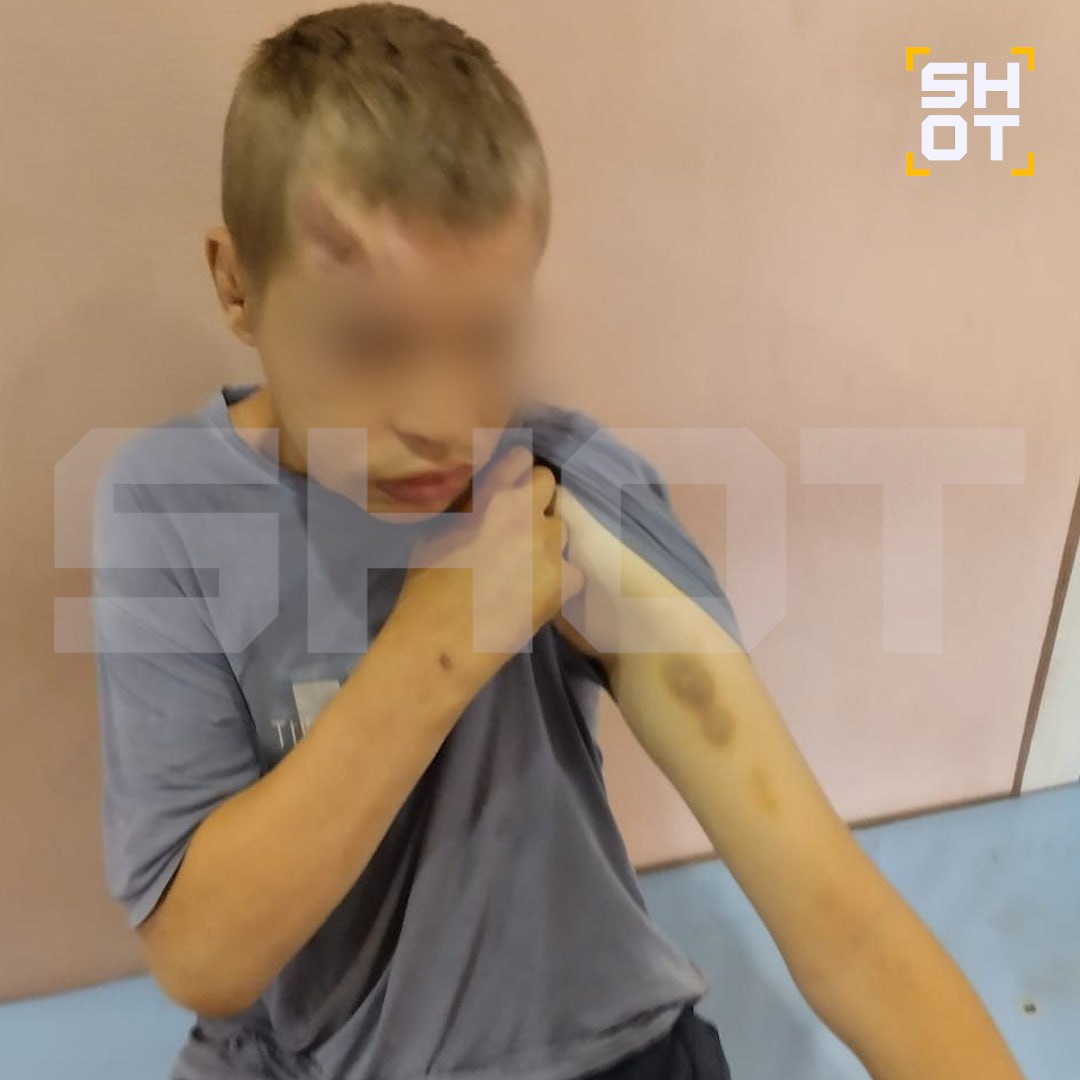 Такое поручение дал губернатор Кузбасса Илья Середюк после случившегося в Прокопьевске. По его словам, контроль должен быть жёстким и всесторонним — от условий проживания и питания до качества медицинской помощи и соблюдения санитарных норм, передает «ТАСС». Напомним, в Прокопьевском психоневрологическом доме-интернате в январе зафиксировали гибель девяти постояльцев после того, как в учреждении выявили вспышку вирусной инфекции, предположительно гриппа А. Как сообщил министр здравоохранения региона Андрей Тарасов, число госпитализированных сократилось с 62 до 51, но четыре человека находятся в тяжелом состоянии.