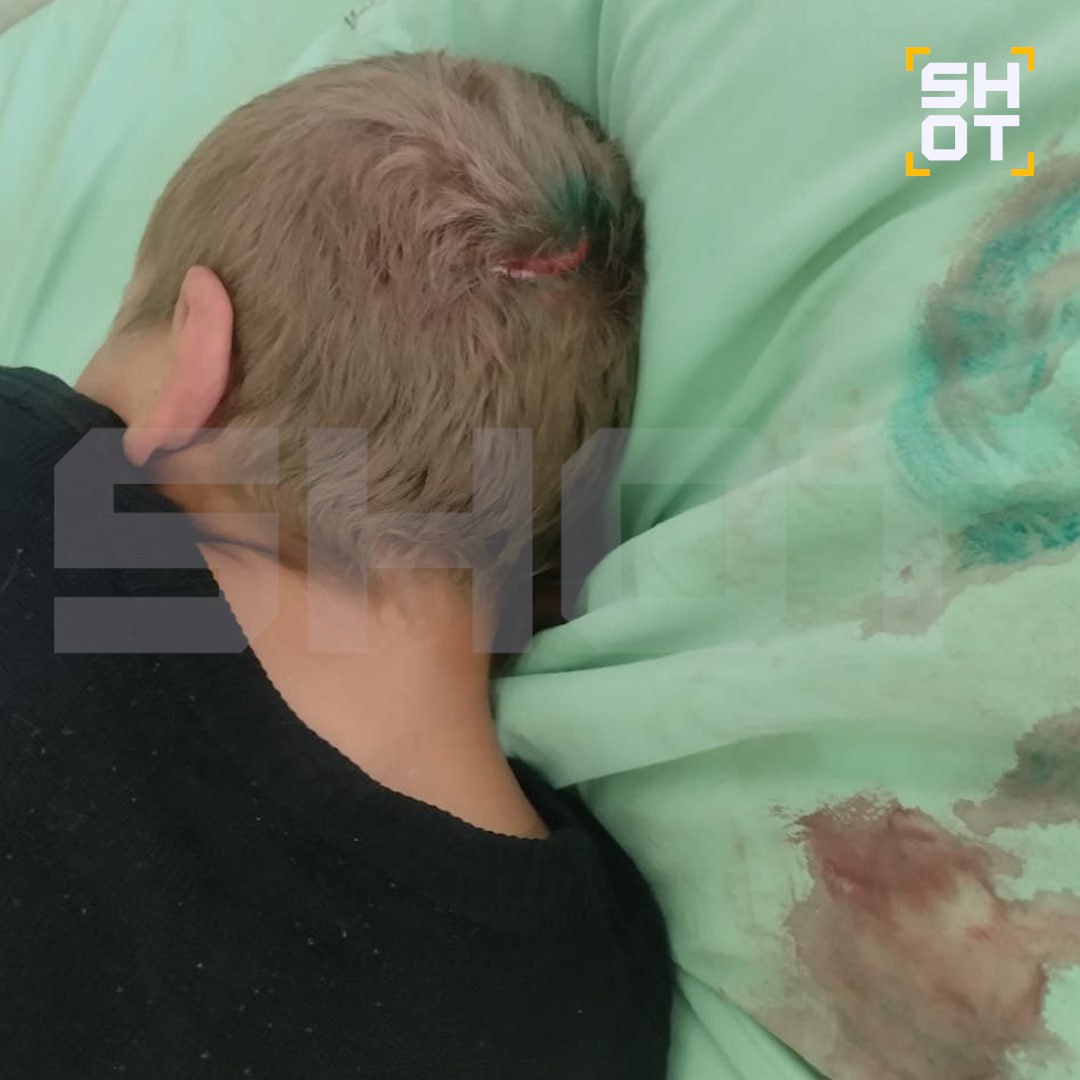 Такое поручение дал губернатор Кузбасса Илья Середюк после случившегося в Прокопьевске. По его словам, контроль должен быть жёстким и всесторонним — от условий проживания и питания до качества медицинской помощи и соблюдения санитарных норм, передает «ТАСС». Напомним, в Прокопьевском психоневрологическом доме-интернате в январе зафиксировали гибель девяти постояльцев после того, как в учреждении выявили вспышку вирусной инфекции, предположительно гриппа А. Как сообщил министр здравоохранения региона Андрей Тарасов, число госпитализированных сократилось с 62 до 51, но четыре человека находятся в тяжелом состоянии.