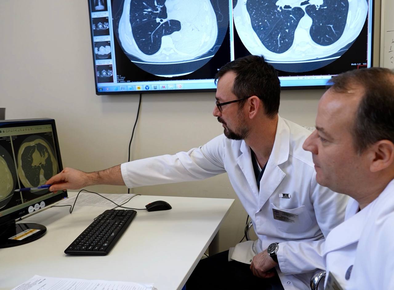 В Клинику факультетской хирургии им. Н. Н. Бурденко Сеченовского Университета поступил пациент с диагностированным плоскоклеточным раком легкого в критическом состоянии. Опухоль располагалась в просвете левого главного бронха. Мужчина практически не мог двигаться из-за резкой слабости и одышки, показатели сатурации были крайне низкими (70-72%). «Заболевание началось в сентябре и сначала пациенту установили диагноз внебольничная пневмония, которую лечили амбулаторно. Затем мужчина был госпитализирован в инфекционную больницу. В медицинском учреждении при бронхоскопии была впервые выявлена опухоль. В течении последующей недели его состояние сильно декомпенсировалось», — рассказал «Медицинской России» заведующий хирургическим торакальным отделением Клиники госпитальной хирургии Сеченовского Университета Таймураз Каллагов.