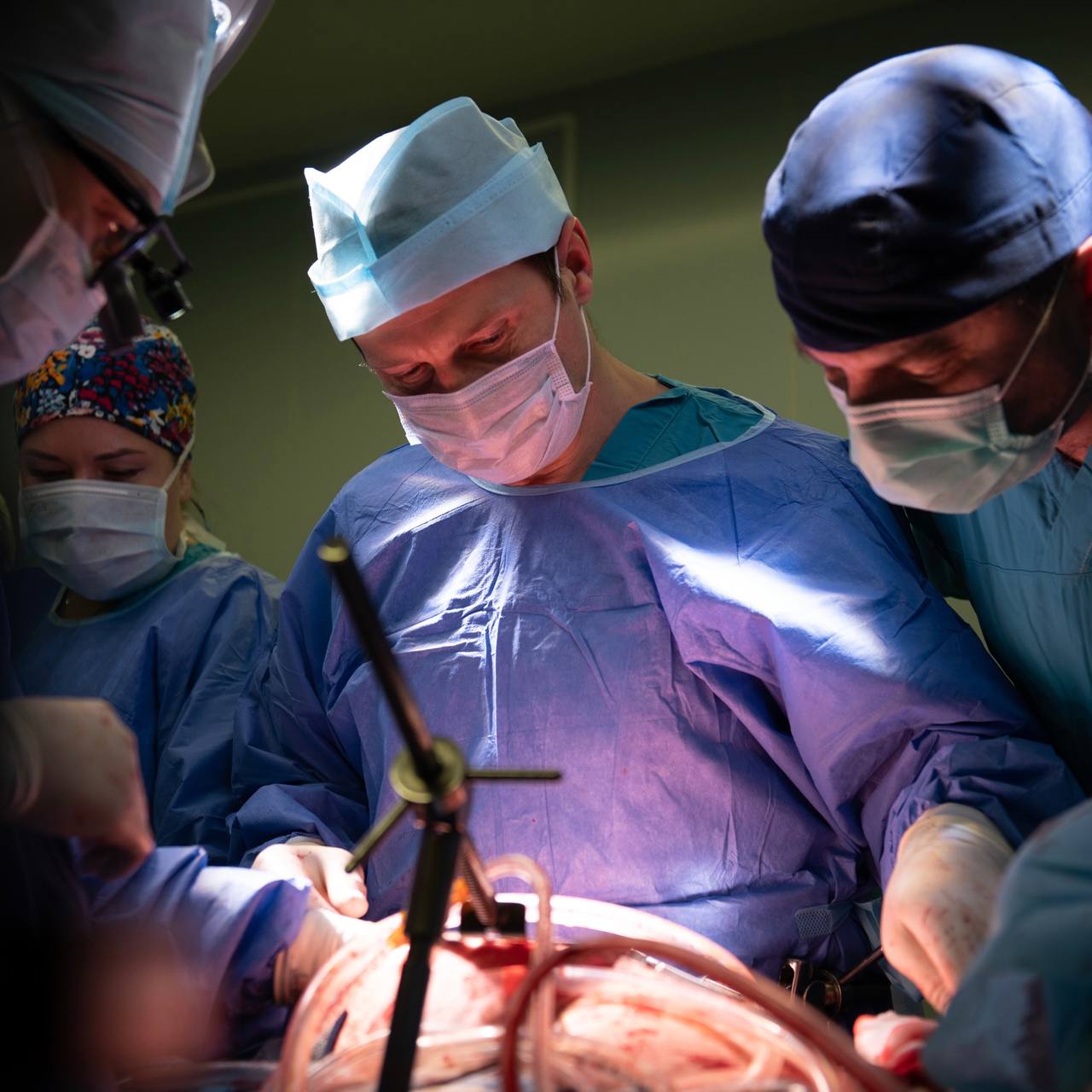 В ФГБУ «НМИЦ Онкологии им. Н.Н. Блохина» поступил мужчина с крайне редкой и агрессивной опухолью сердца — саркомой. Такое новообразование встречается с частотой 1 на 50 тысяч. Несколько клиник отказали пациенту в лечении, считая случай безнадёжным. До опухоли было сложно добраться, а полностью удалить — почти невозможно. Новообразование стремительно росло, практически перекрыло кровоток в сердце, опустилось по нижней полой вене и достигло печени, сформировав опухолевый тромб длиной 10 см.