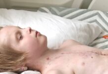 Медицинская команда проводит лечение ребенка с врожденным пороком сердца
